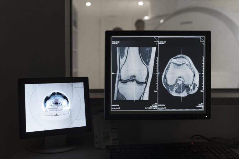 <strong>Bringing Radiology Home: Unlocking the Convenience and Efficiency of X-ray Testing Services at Your Doorstep</strong>